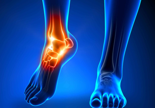Expert Insights: Understanding Ankle Pain and How to Treat It